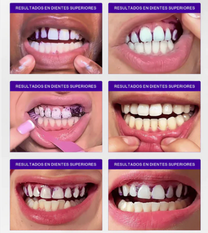 WHITENING STRIPS V34 - Tiras Blanqueadoras