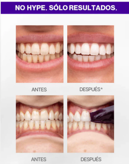 WHITENING STRIPS V34 - Tiras Blanqueadoras